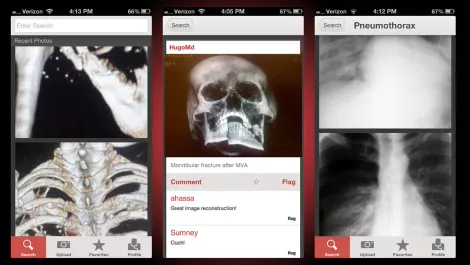 New learning tool for healthcare professionals